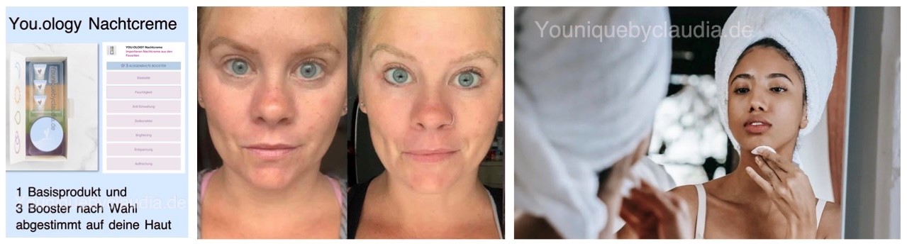 Younique Youology Nachtcreme Rosazea Rosacea Neurodermitis Schuppenflechte Couperose