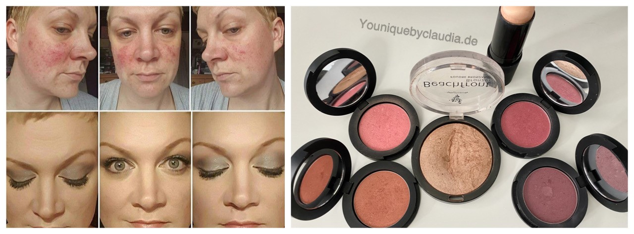 Younique Erfahrungsbericht Rouge Bronzer Rosazea Neurodermitis Schuppenflechte vorher nachher
