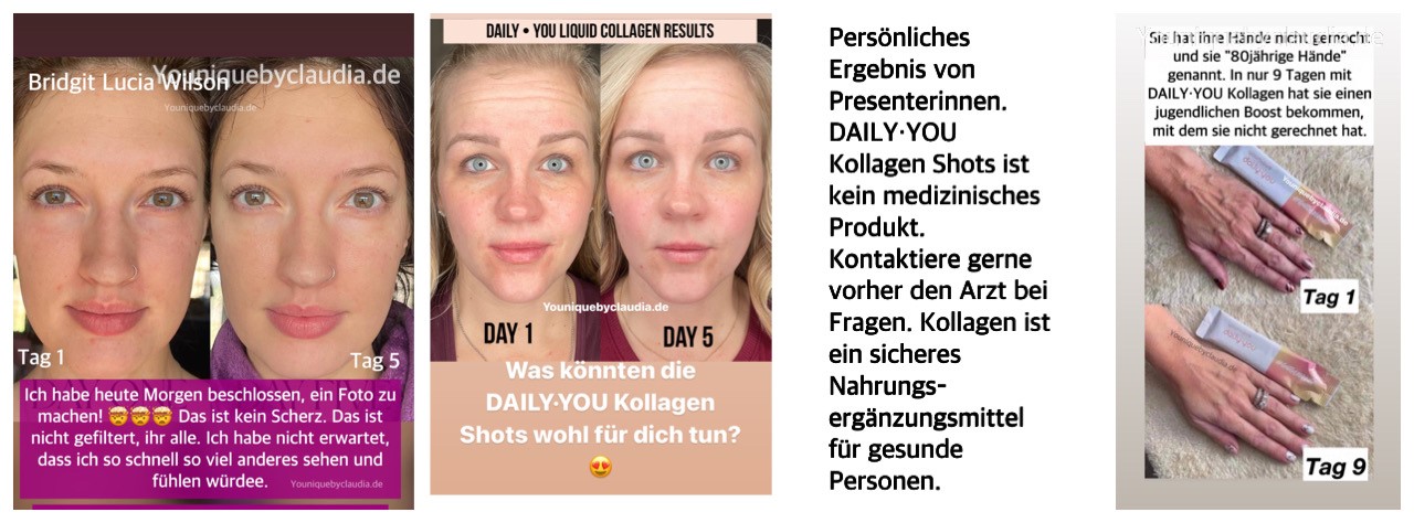 Younique Daily You Kollagen Cellulite persönliches Ergebnis 2