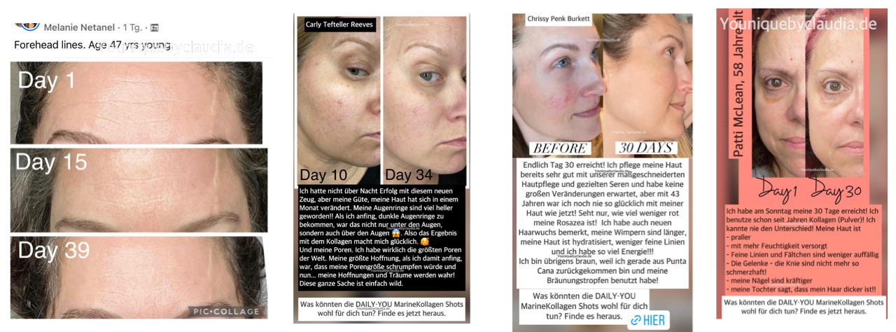 Younique Daily You Kollagen Rosazea persönliches Ergebnis