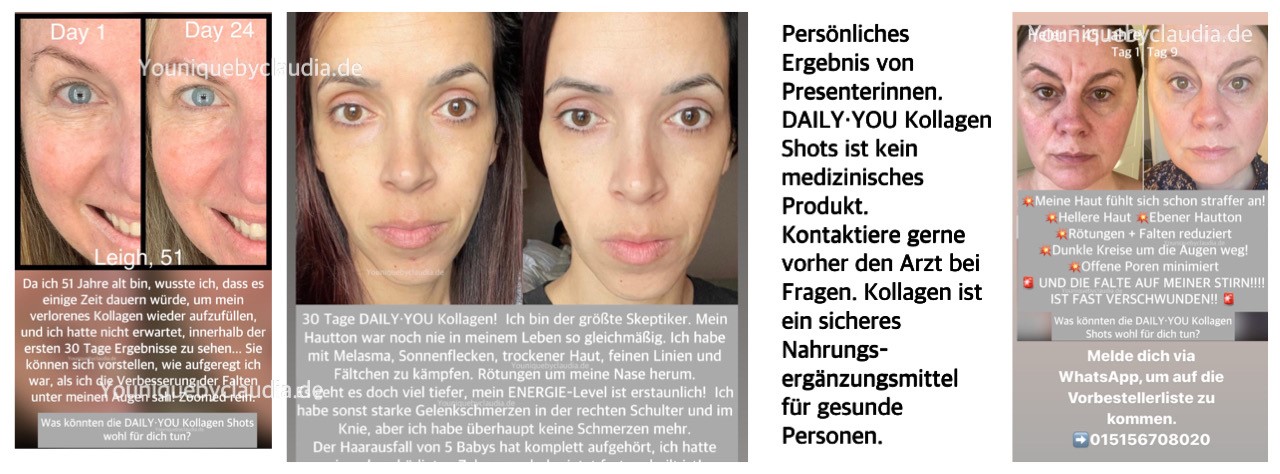 Younique Daily You Kollagen vorher nachher persönliches Ergebnis 1